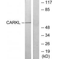 CARKL Antibody 