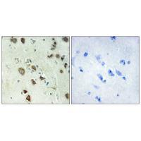 S6K-α6 Antibody