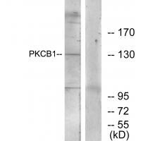 PKCB1 Antibody 