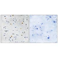 DIL-2 Antibody 