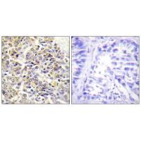 ASC Antibody 