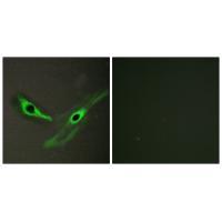 ICK Antibody 