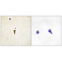 ICK Antibody 