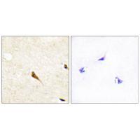 MOK Antibody 