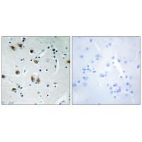 ZNF148 Antibody 