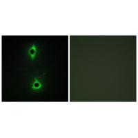 PIP5K Antibody 