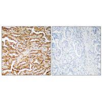 GIT1 Antibody