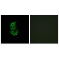STA13 Antibody