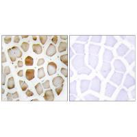 ATG4B Antibody 