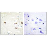 MRCKB Antibody 