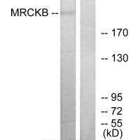 MRCKB Antibody 