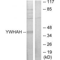 14-3-3 η Antibody 