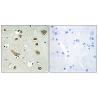 14-3-3 γ Antibody 
