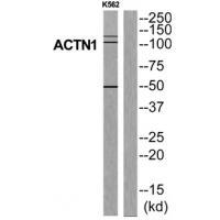ACTN1 Antibody