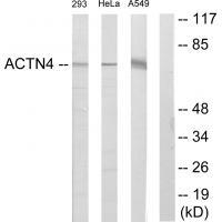 ACTN4 Antibody