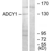 ADCY1 Antibody 