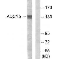 ADCY5 Antibody