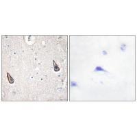 ADCY5/6 Antibody 