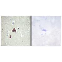ADCY8 Antibody