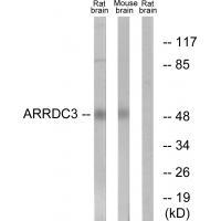 ARRDC3 Antibody 