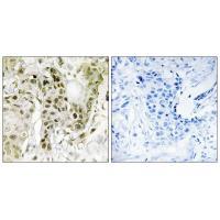 BCOR Antibody 