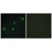 CDCA4 Antibody 