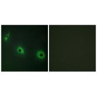 CELSR3 Antibody 