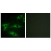 Collagen I α2 Antibody 