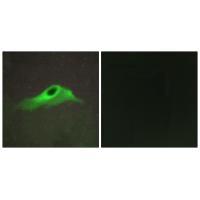 Collagen IV α5 Antibody 