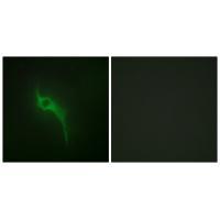 Collagen V α1 Antibody 