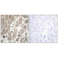 Collagen V α1 Antibody 