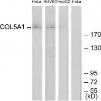Collagen V α1 Antibody 