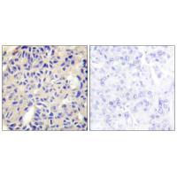 Collagen V α2 Antibody 