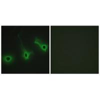 Collagen V α3 Antibody