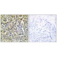 Collagen VI α2 Antibody 