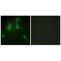 Collagen IX α3 Antibody 