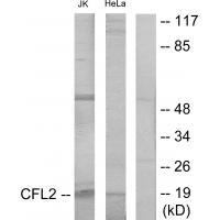 Cofilin Antibody 