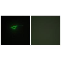 Collagen XX α1 Antibody 