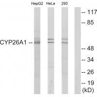 Cytochrome P450 26A1 Antibody 