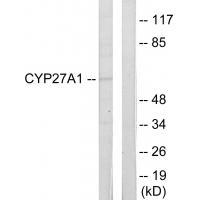 Cytochrome P450 27A1 Antibody 