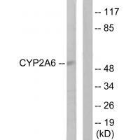 Cytochrome P450 2A6 Antibody 