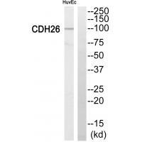 Cytochrome P450 2C8 Antibody 