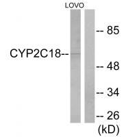 Cytochrome P450 2C8/9/18/19 Antibody