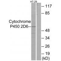 Cytochrome P450 2D6 Antibody 