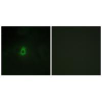 Cytochrome P450 2E1 Antibody 