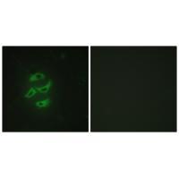 Cytochrome P450 2J2 Antibody 