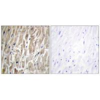 Cytochrome P450 2J2 Antibody 
