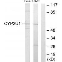 Cytochrome P450 2U1 Antibody