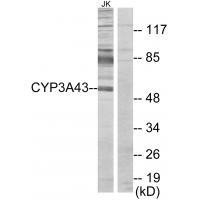 Cytochrome P450 3A43 Antibody