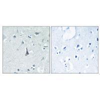 Cytochrome P450 3A4 Antibody